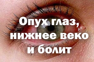 Опух глаз, нижнее веко и болит Опух глазик, нижнее веко и болит