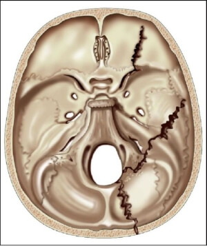 Виды Виды