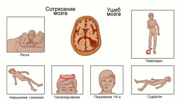 Что испытывают пострадавшие Признаки