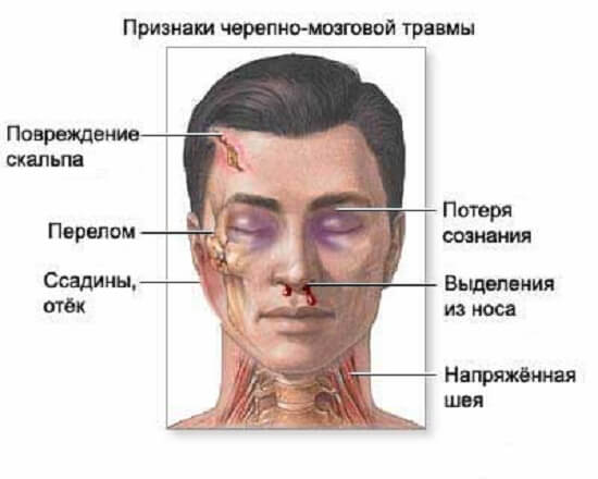 Пострадавший Повреждение