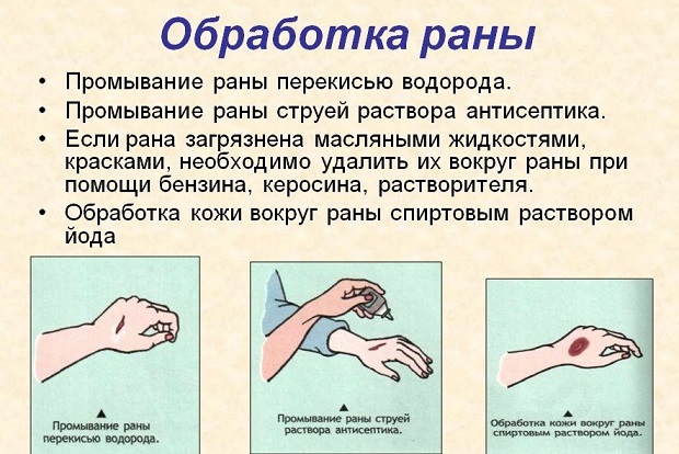 Обработка Обработка пореза