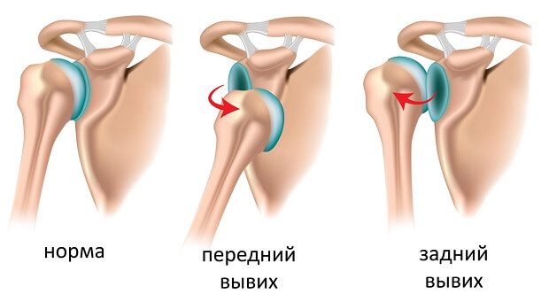 Какие бывают Виды