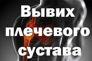 Снимок Локализация