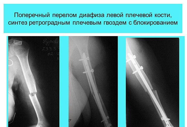 Снимок Рентген