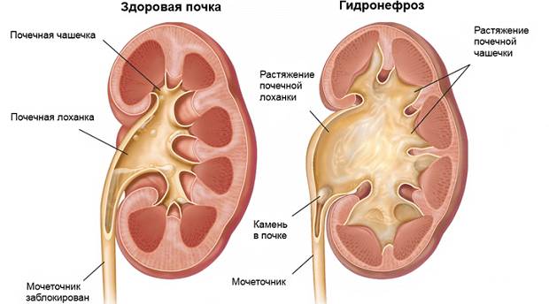 Болезнь Появилась болезнь