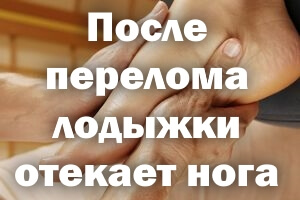 Если отекает нога Что делать, если после перелома лодыжки отекает нога