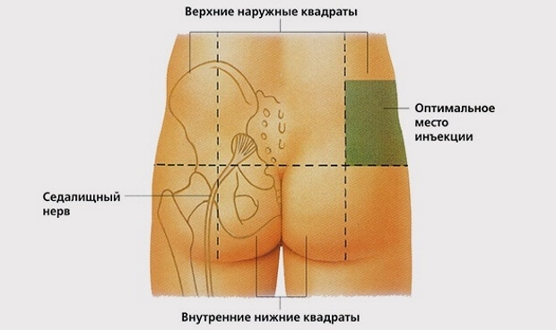 Место Оптимальное место