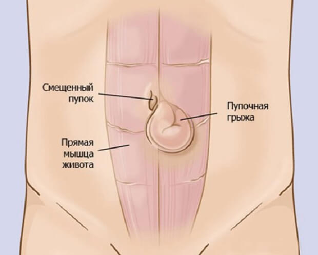 Расположение Как выглядит