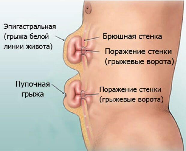 В чем отличие Отличия