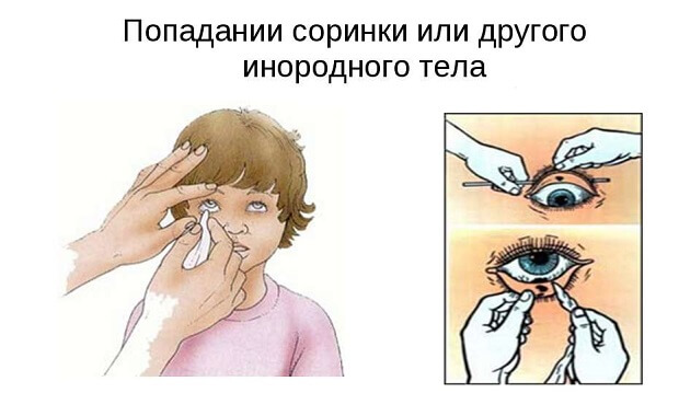 Помощь Помощь ребенку