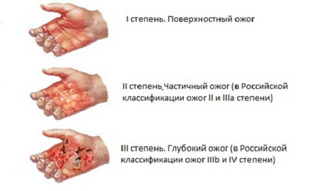 Степень Различные степени