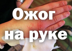 Больно Как выглядит