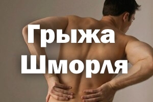 Эта проблема У мужчины