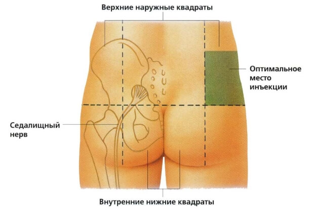 Куда ставить Куда делать