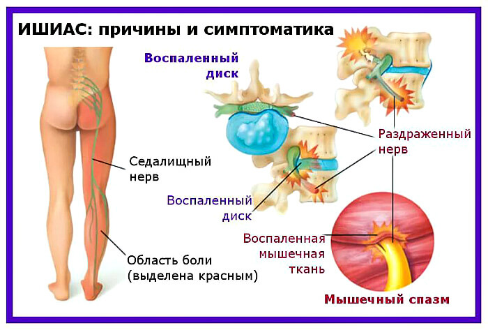 Поменять Симптоматика и причины болезни