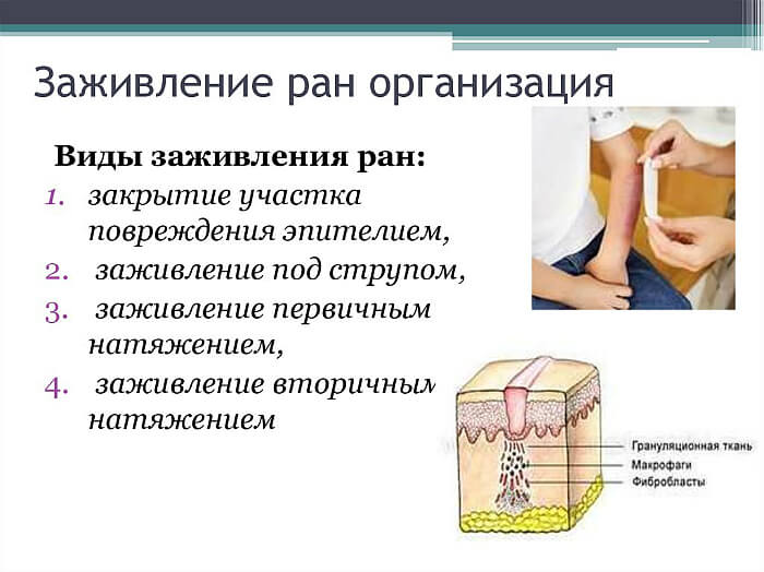 Поменять Способы заживления