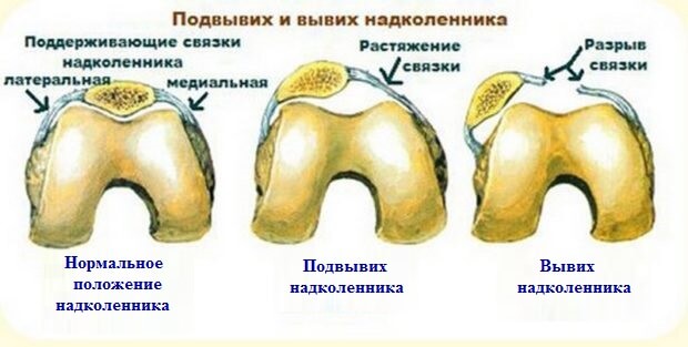 Повреждение Травма