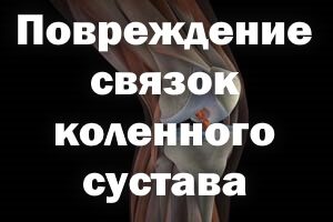 Схема Как выглядит
