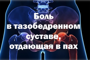 Боль в тазобедренном суставе, отдающая в пах Боль в тазобедренном суставе, отдающая в паховую область