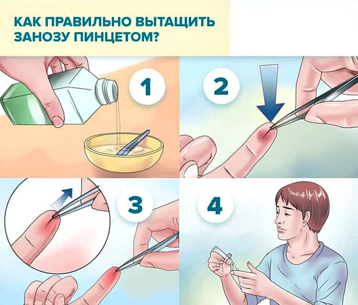 Поменять Пинцет