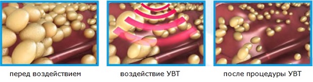 На организм Воздействие на организм