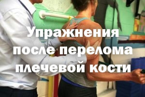 Упражнения после перелома плеча Упражнения после перелома плечевой кости
