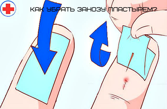 Поменять Пластырь