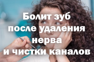 Болит зуб после удаления нерва и чистки каналов Болит зубик после удаления нерва и чистки каналов